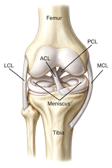 rottura-del-legamento-crociato-anteriore-s73kXfkl8e anatomia ginocchio